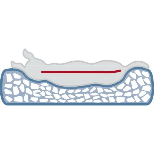 Trixie Cama Vital Bendson 7 Trixie Cama Vital Bendson - Imagen 5